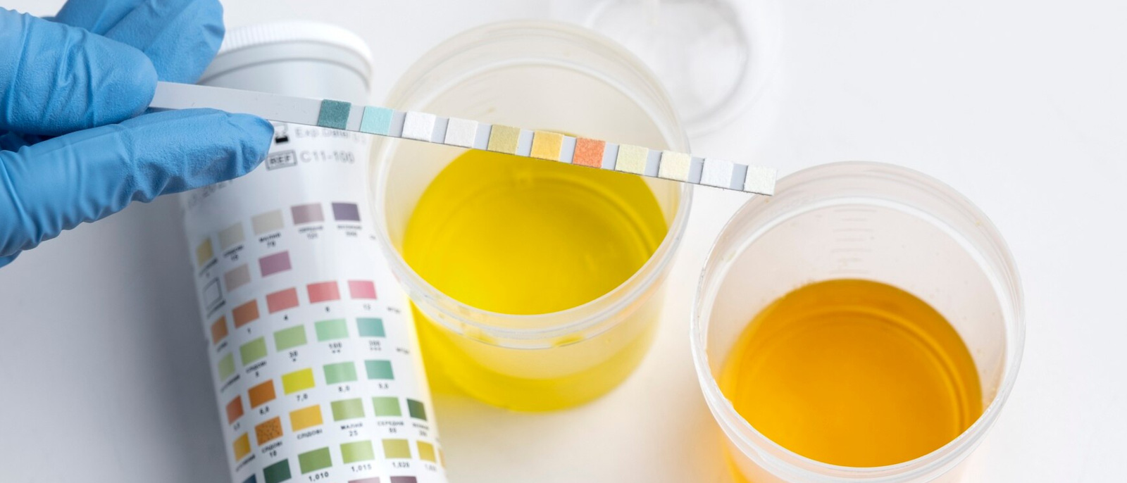 pavia-analisi-urine